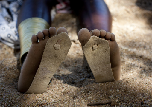 Mucubal Wearing Too Small Flip Flops, Virie Area, Angola