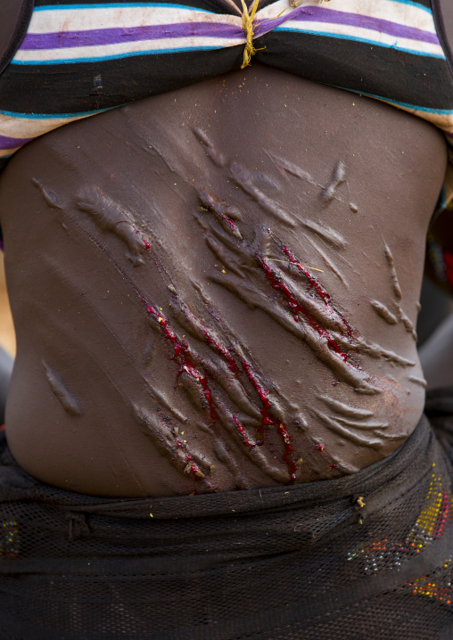 Bashada Tribe Woman Whipped During A Bull Jumping Ceremony, Dimeka, Omo Valley, Ethiopia