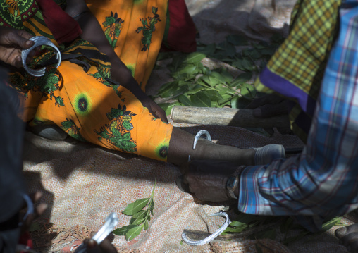 Karrayyu Blacksmith Putting A New Ankle On A Girl For Her Wedding, Metahara, Ethiopia