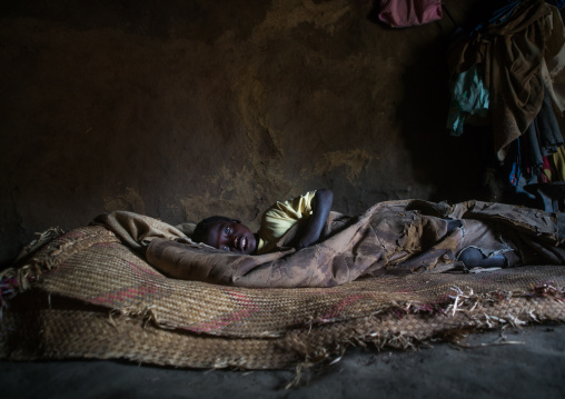 Ethiopian boy called abushe with blue eyes suffering from waardenburg syndrome, Omo valley, Jinka, Ethiopia