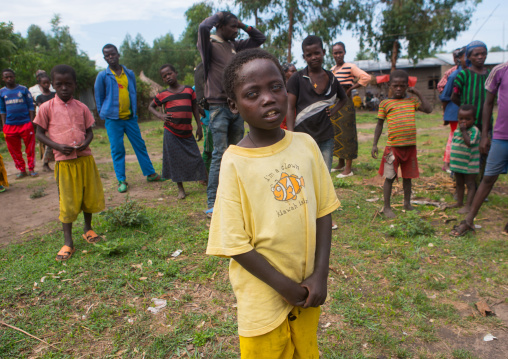 Ethiopian boy called abushe with blue eyes suffering from waardenburg syndrome, Omo valley, Jinka, Ethiopia