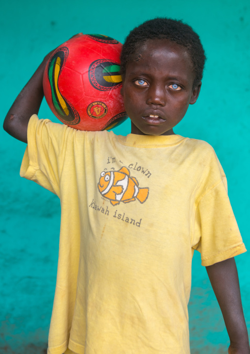 Ethiopian boy called abushe with blue eyes suffering from waardenburg syndrome, Omo valley, Jinka, Ethiopia