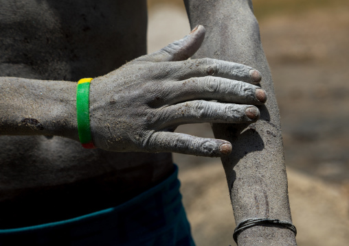 Borana tribe man arms wounded after diving in the volcano crater to collect salt, Oromia, El Sod, Ethiopia