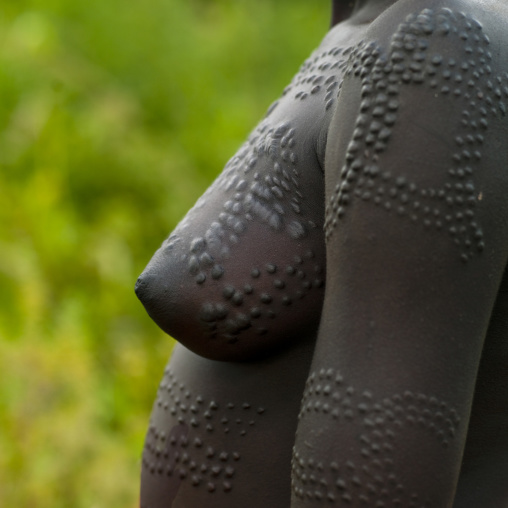 Scarifications On A Surma Woman Body, Turgit Village, Omo Valley, Ethiopia