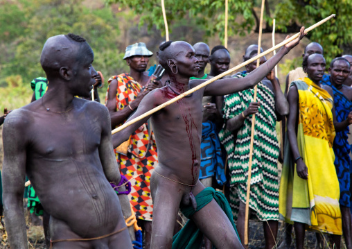 Suri tribe warrior bleeding during a donga stick fighting ritual, Omo valley, Kibish, Ethiopia