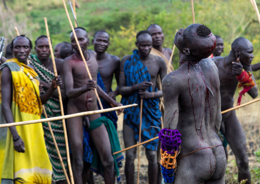 Suri tribe warrior bleeding during a donga stick fighting ritual, Omo valley, Kibish, Ethiopia