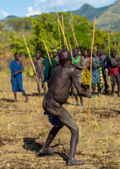 Suri tribe warrior wounded during a donga stick fighting ritual, Omo valley, Kibish, Ethiopia