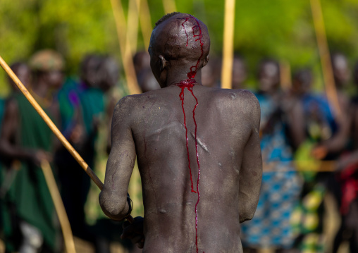 Suri tribe warrior bleeding during a donga stick fighting ritual, Omo valley, Kibish, Ethiopia