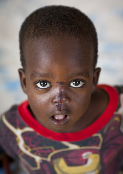 Mingi baby rescued in omochild foundation, Jinka, Omo valley, Ethiopia