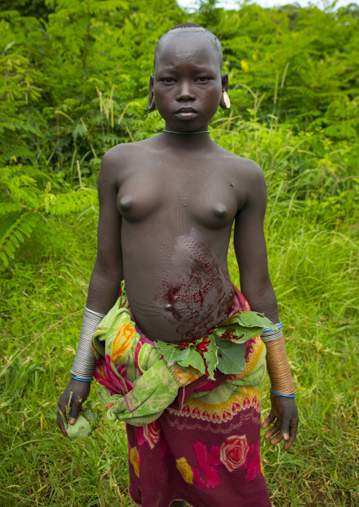 Suri tribe girl showing the scarifications on her belly covered by blood, Tulgit, Omo valley, Ethiopia