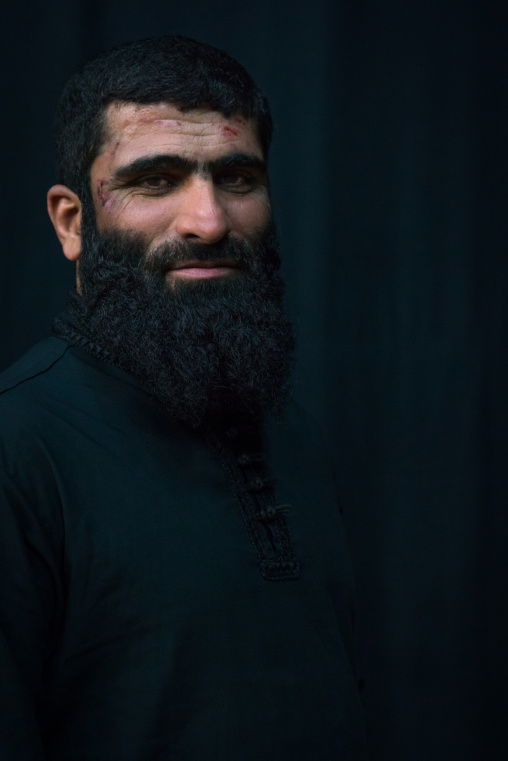 Iranian Shiite Muslim Mourner From The Mad Of Hussein Community With Injuries On His Face Caused By Self-flagellation During Muharram, Isfahan Province, Kashan, Iran