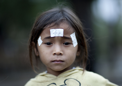 Ill khmu minority child with traditional medicine on the face, Xieng khouang, Laos