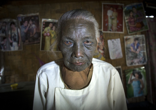 Tribal Chin Woman From U Pu Tribe With Tattoo On The Face, Kanpelet, Myanmar