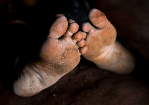 Himba Women Feet, Epupa, Namibia