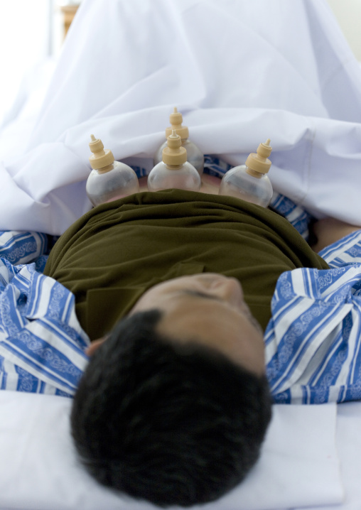 North Korean man having traditional cupping medicine in hopsital, Pyongan Province, Pyongyang, North Korea