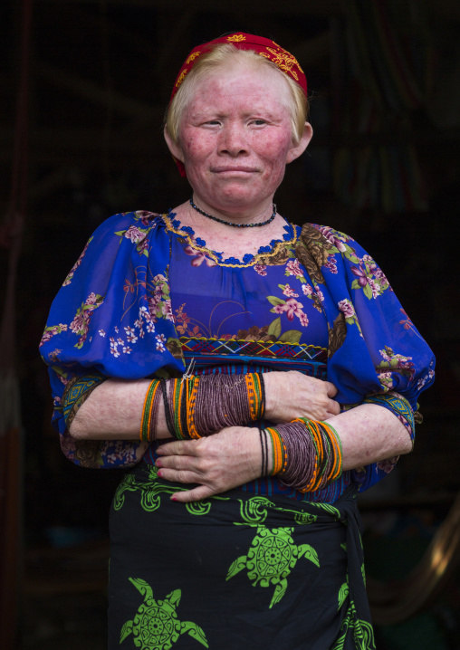 Panama, San Blas Islands, Mamitupu, Portrait Of An Albino Kuna Tribe Woman