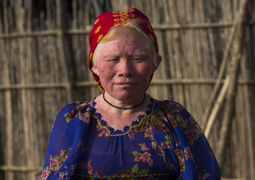 Panama, San Blas Islands, Mamitupu, Portrait Of An Albino Kuna Tribe Woman