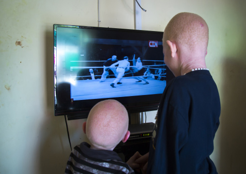 Tanzania, East Africa, Dar es Salaam, albinos children watching television at under the same sun house